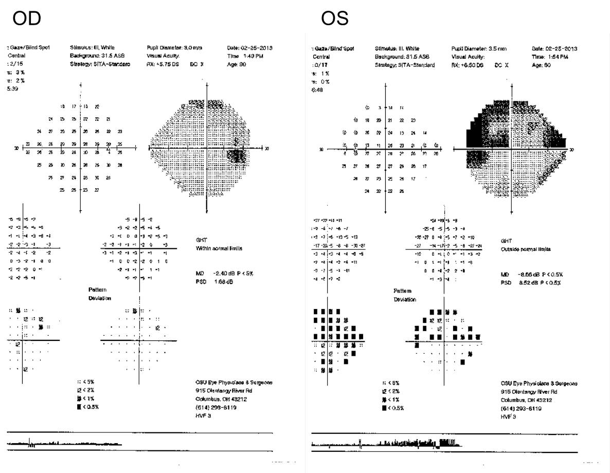 Fig2